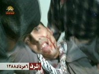 Achraf: liste des blessés graves de l’OMPI nécessitant une intervention urgente un membre de l'OMPI à Achraf blessé par les agents irakien du régime des mollahs