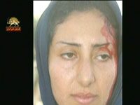 Attaque contre Achraf communiqué no 10 Une membre de l'OMPI blessée par les forces irakiennes