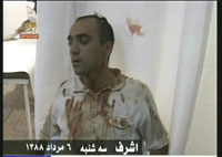 Unmembre de l'OMPI blessé par les agents irakiens du régime des mollahs