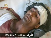 Maryam Radjavi: Lattaque sauvage contre Achraf est un crime de guerre et un crime contre lhumanité Un résident d'Achraf blessé par l'attaque sauvage des agents irakiens du régime des mollahs