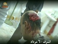 Attaque contre Achraf – Communiqué n° 37 Un résident d'Achraf blessé à coup de baton et de barre de fer à la tête par les forces irakiennes