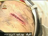 Attaque contre Achraf communiqué n°34 Blessures à coup de barre tranchante assenée à un résident d'AChraf par un agent irakien