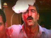 La TV d’Etat irakienne copie honteusement la TV des mollahs à Téhéran pour couvrir des crimes Un résident de la Cité d'AChraf blessés par les forces répressives irakiennes