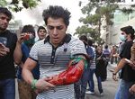 Iran : des médecins dénoncent la terreur dans les hôpitaux Un blessé dans une manifestation à Téhéran