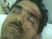 La police matraque et blesse les résidents du camp dAchraf Rapport à Amnesty International Le Modjahed Peyman Kord-Amir, résident de la Cité d'Achraf, dans le coma après de violents coups sur la tête portés par la police irakienne