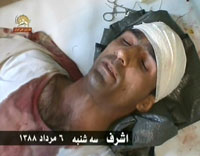 R&eacute;sident d'Achraf bless&eacute; par les forces r&eacute;pressives irakiennes