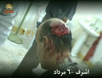 r&eacute;sident d'Achraf bless&eacute; par les forces arm&eacute;es irakiennes 