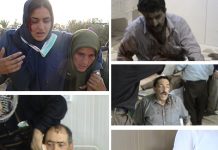 Massacre à Ashraf Blessés d'Achraf lors de l'attaque sauvage des forces irakiennes le s28 et 29 juillet