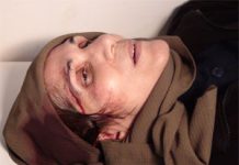 108 résidents d’Achraf, dont 55 femmes, touchés et blessés par des jets de pierres