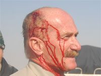 Le nombre d’Achrafiens blessés se monte à 155, les forces irakiennes expulsent les blessés de l’hôpital