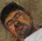 Brûler à l’acide le visage d’un écrivain afghan traduit la sauvagerie sans borne du régime des mollahs