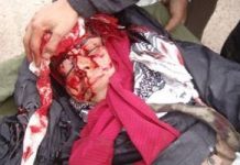 Bain de sang à Achraf, une catastrophe humanitaire