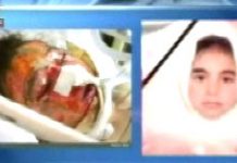 Iran : Décès de deux écolières de 10 ans des suites de leurs brûlures