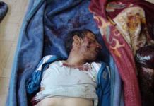 Le nombre des blesses s’élève à une centaine, dont des blessés graves.