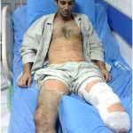 La Résistance iranienne appelle une fois de plus au transfert en Europe des blessés graves de la 4e attaque sur Liberty