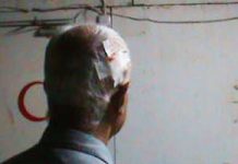 Urgent: Tir d’une balle de kalachnikov dans un baraquement de Liberty : un blessé