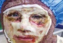 Protestation contre les attaques au vitriol et la loi visant à protéger les racoleurs moralisateurs en Iran Iran acid attack
