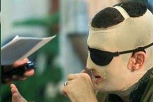 Iran – Les mollahs ordonnent aux médecins d’enlever un œil et de couper une oreille d’un prisonnier