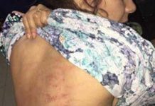 Une Iranienne demandeuse d’asile en Norvège renvoyée par le gouvernement en Iran où elle a été fouettée