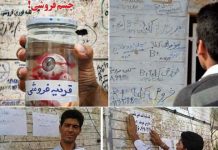 En proie à la pauvreté, des Iraniens vendent les organes de leurs corps En proie à la pauvreté, des Iraniens vendent les organes de leurs corps