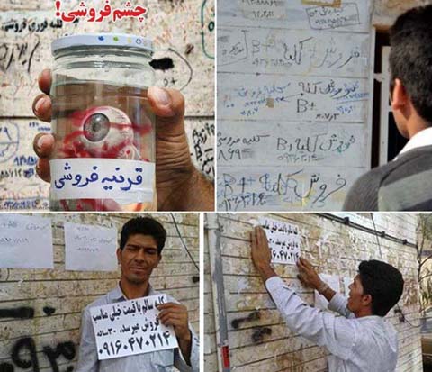 En proie à la pauvreté, des Iraniens vendent les organes de leurs corps