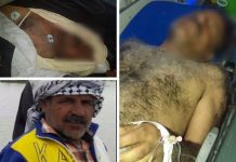 Vidéo – Iran : Les pasdaran tuent un manifestant et blessent plusieurs autres personnes Iran : Les pasdaran tuent un manifestant et blessent plusieurs autres personnes