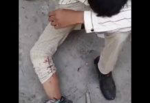 Un jeunes lycéens blessé par balles lors de la manifestation à Lordegan en Iran