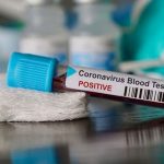 L’incurie du pouvoir iranien face à l’épidémie de coronavirus
