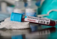 L’incurie du pouvoir iranien face à l’épidémie de coronavirus